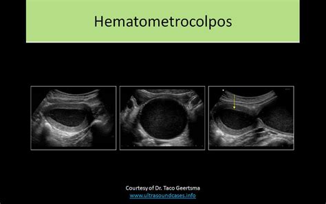 clinica serrano ob-gyne & ultrasound